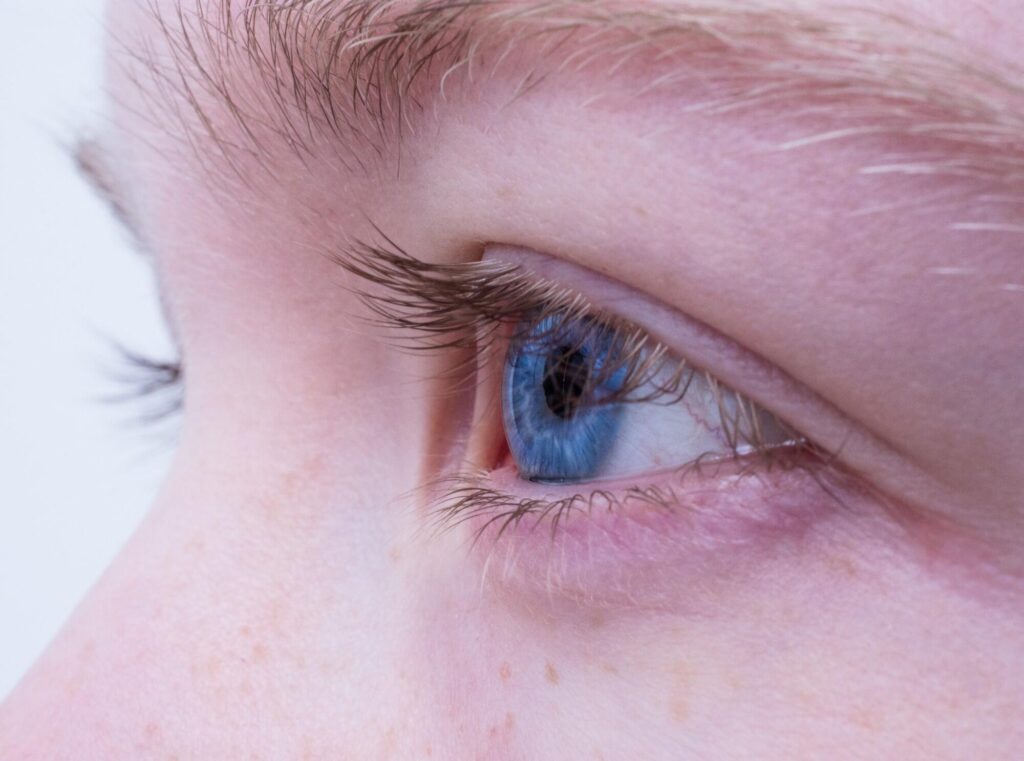 Understanding the Causes of Dry Eyes and the Role of Eyelid Hygiene